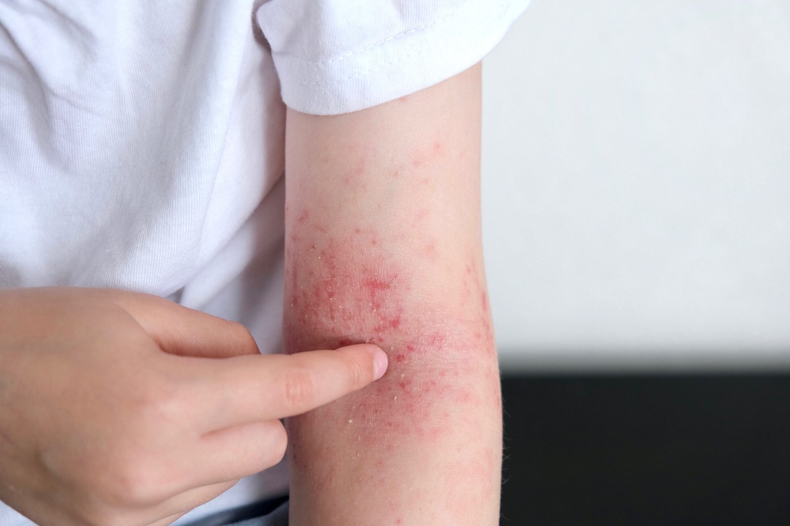 skin issues
