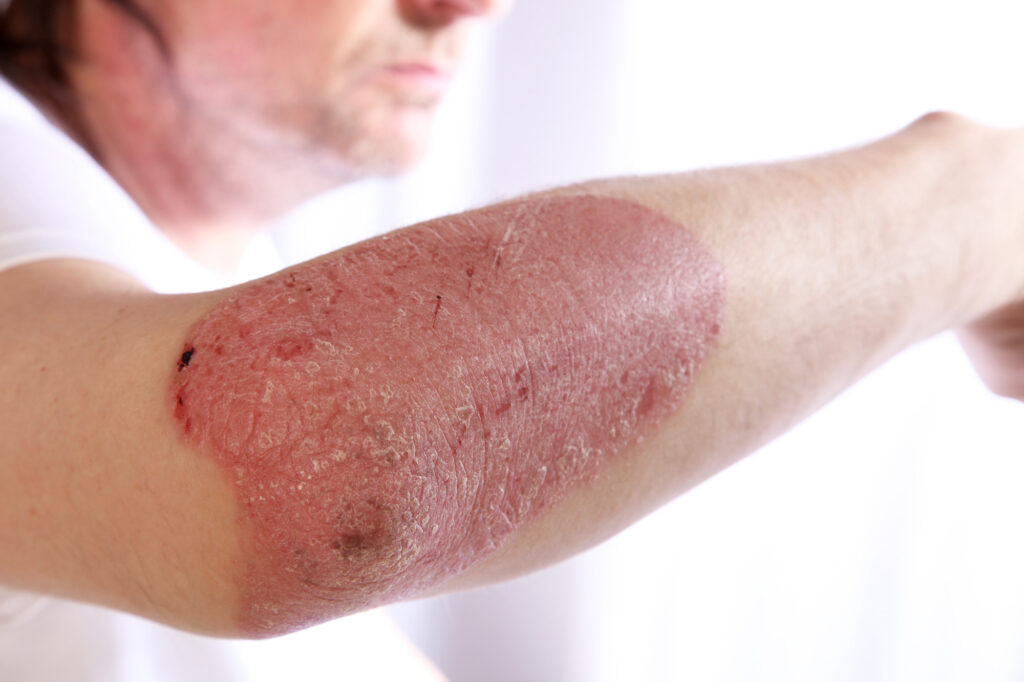 skin issues